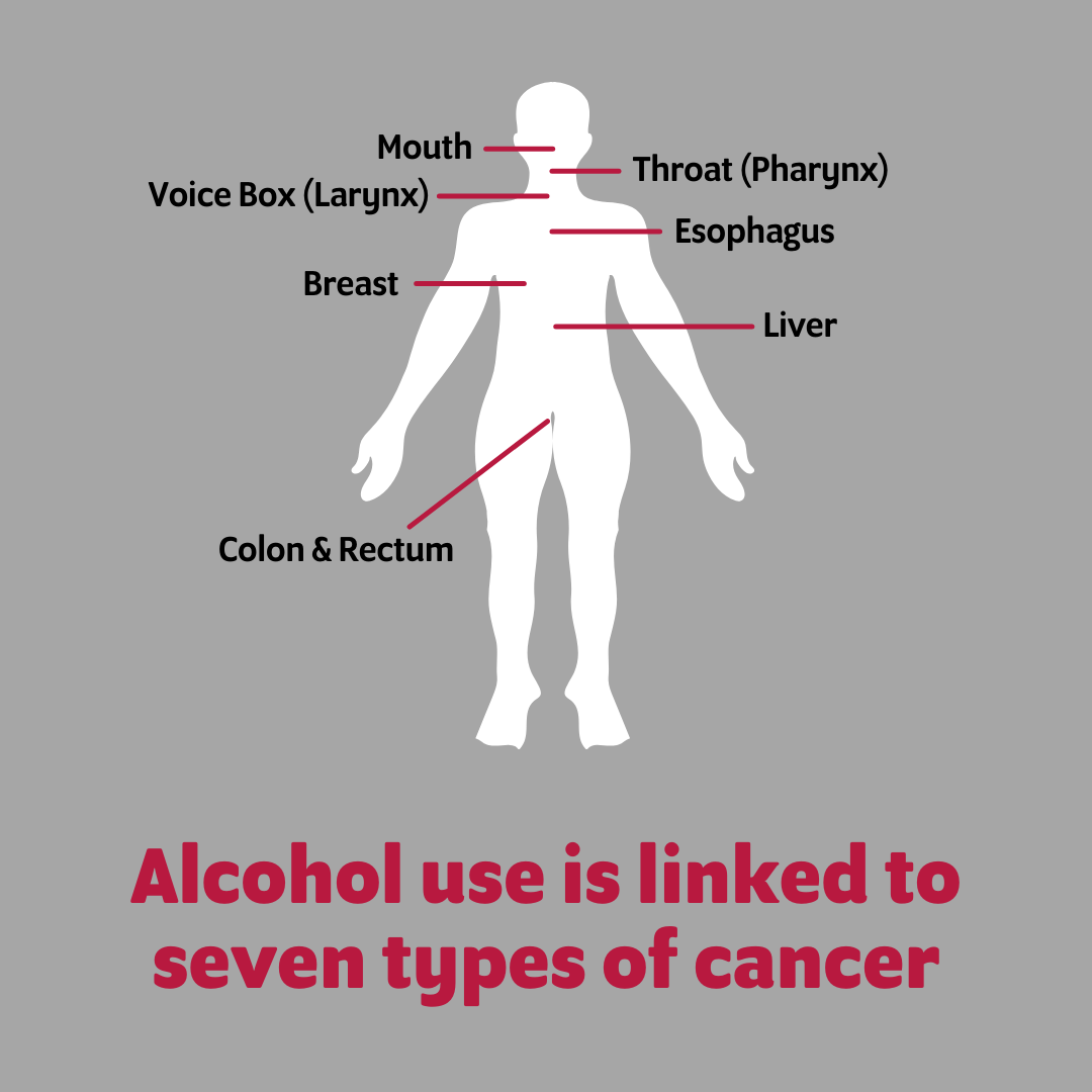 Alcohol is linked to 7 types of cancer